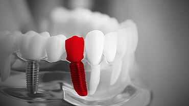 ZwickRoell preskusni sistemi za zobozdravstveno industrijo